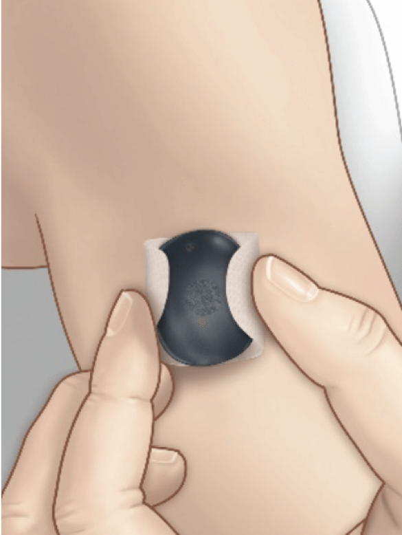 Always use Placement.png