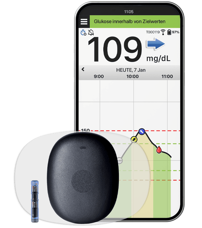 Eversense CGM