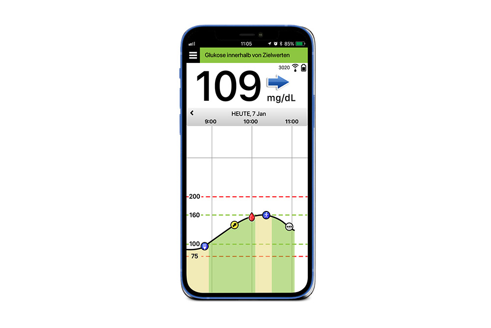 Handybildschirm, auf dem Eversense System App mit CGM-Technik zu sehen ist